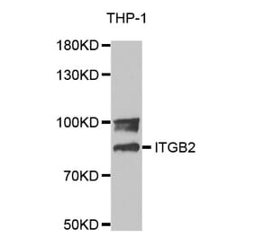 Western blot - ITGB2 Antibody from Signalway Antibody (32640) - Antibodies.com