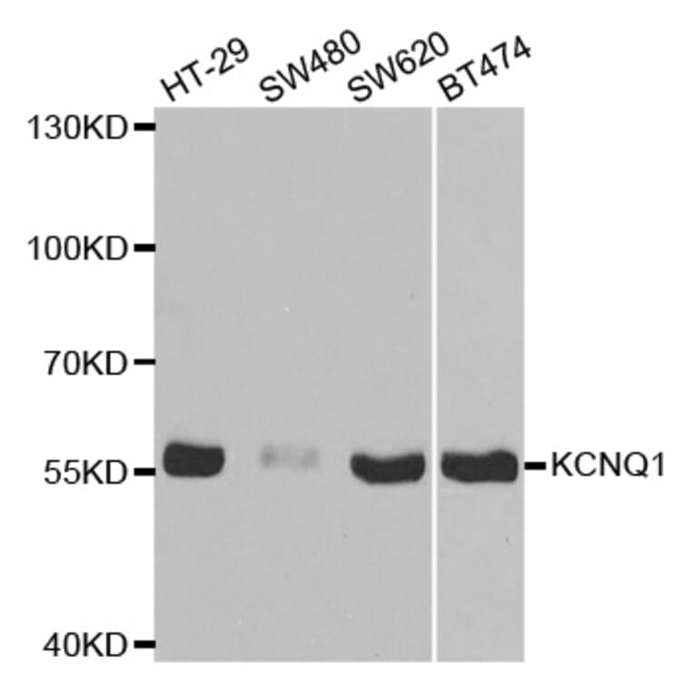 Western blot - KCNQ1 Antibody from Signalway Antibody (32641) - Antibodies.com