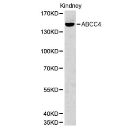 Western blot - ABCC4 Antibody from Signalway Antibody (32660) - Antibodies.com