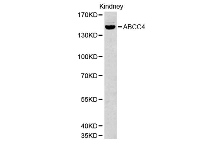 Western blot - ABCC4 Antibody from Signalway Antibody (32660) - Antibodies.com