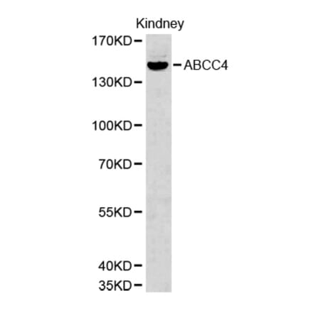 Western blot - ABCC4 Antibody from Signalway Antibody (32660) - Antibodies.com