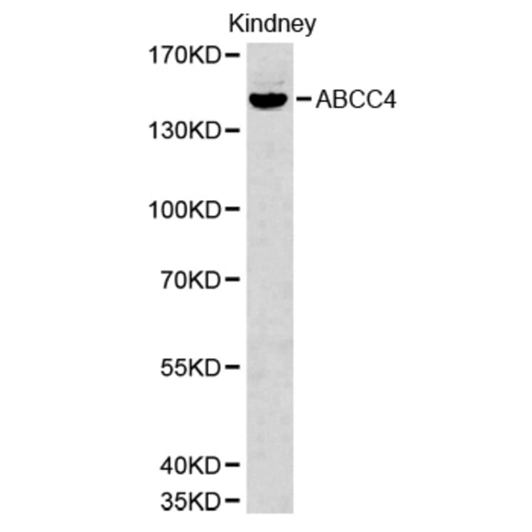 Western blot - ABCC4 Antibody from Signalway Antibody (32660) - Antibodies.com