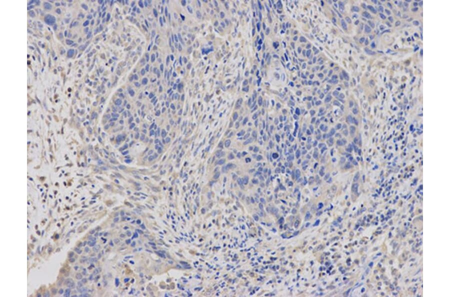 Immunohistochemistry - ABCC4 Antibody from Signalway Antibody (32660) - Antibodies.com