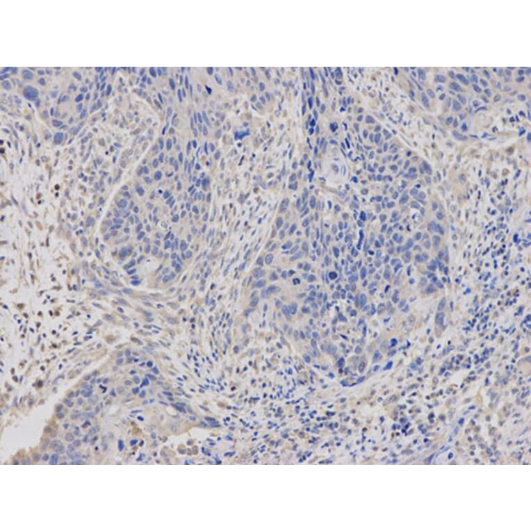 Immunohistochemistry - ABCC4 Antibody from Signalway Antibody (32660) - Antibodies.com