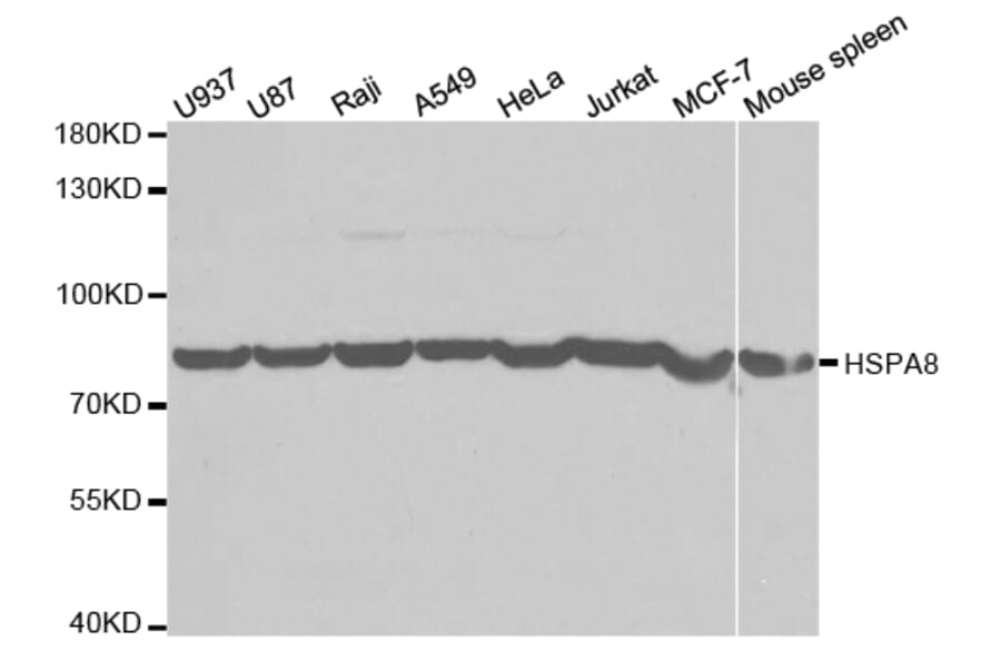Western blot - HSPA8 Antibody from Signalway Antibody (32668) - Antibodies.com
