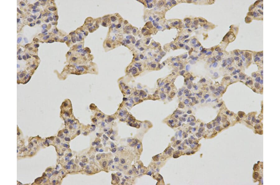 Immunohistochemistry - HSPA8 Antibody from Signalway Antibody (32668) - Antibodies.com