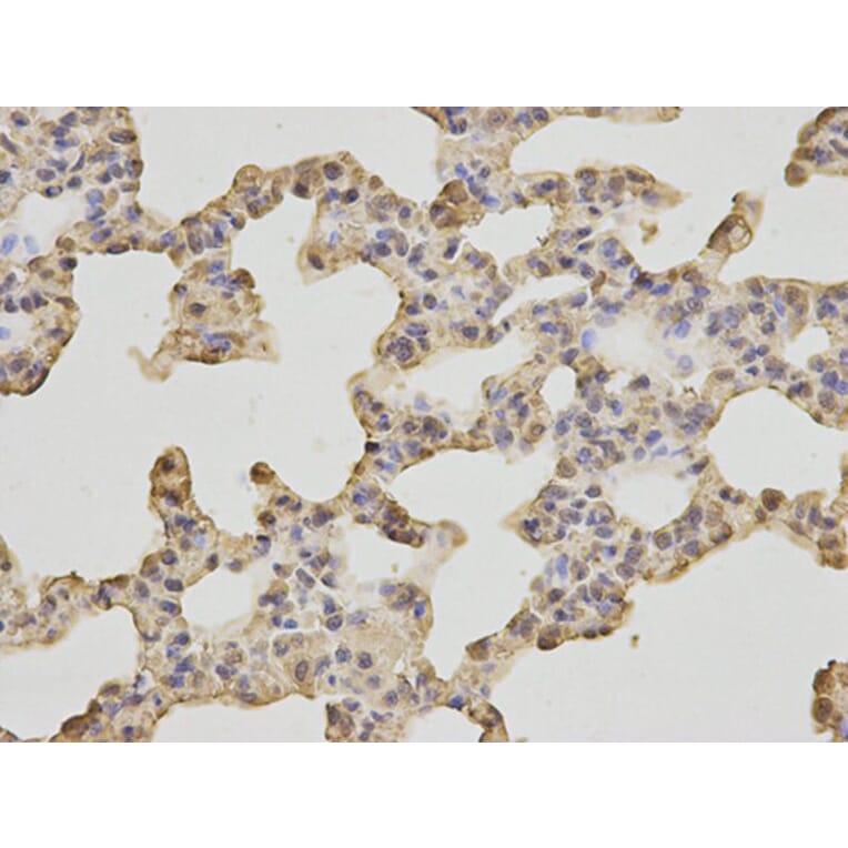 Immunohistochemistry - HSPA8 Antibody from Signalway Antibody (32668) - Antibodies.com