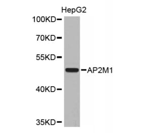Western blot - AP2M1 Antibody from Signalway Antibody (32670) - Antibodies.com