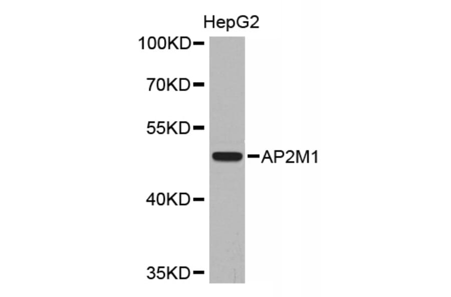 Western blot - AP2M1 Antibody from Signalway Antibody (32670) - Antibodies.com