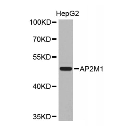 Western blot - AP2M1 Antibody from Signalway Antibody (32670) - Antibodies.com