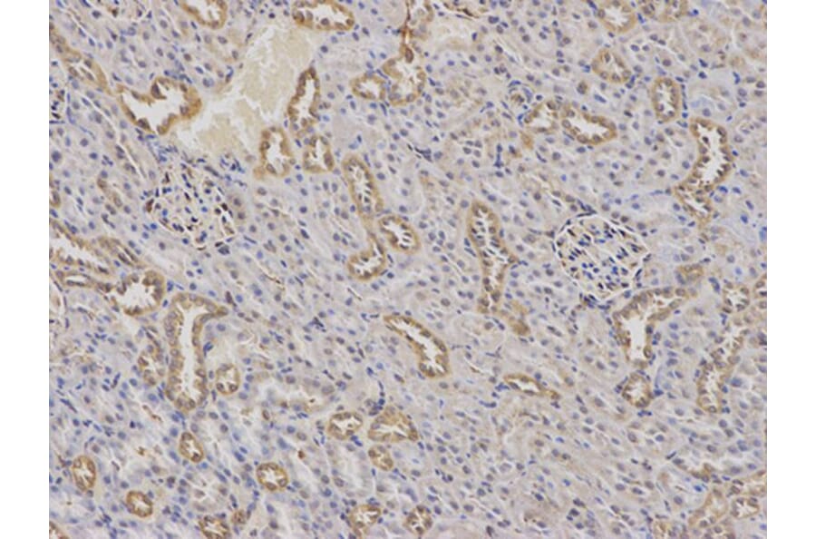 Immunohistochemistry - AP2M1 Antibody from Signalway Antibody (32670) - Antibodies.com