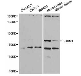 Western blot - FOXM1 Antibody from Signalway Antibody (32671) - Antibodies.com