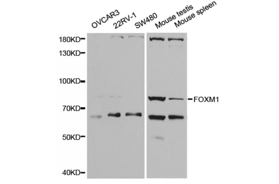 Western blot - FOXM1 Antibody from Signalway Antibody (32671) - Antibodies.com
