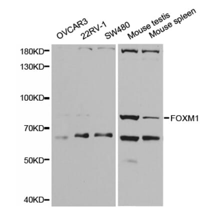 Western blot - FOXM1 Antibody from Signalway Antibody (32671) - Antibodies.com