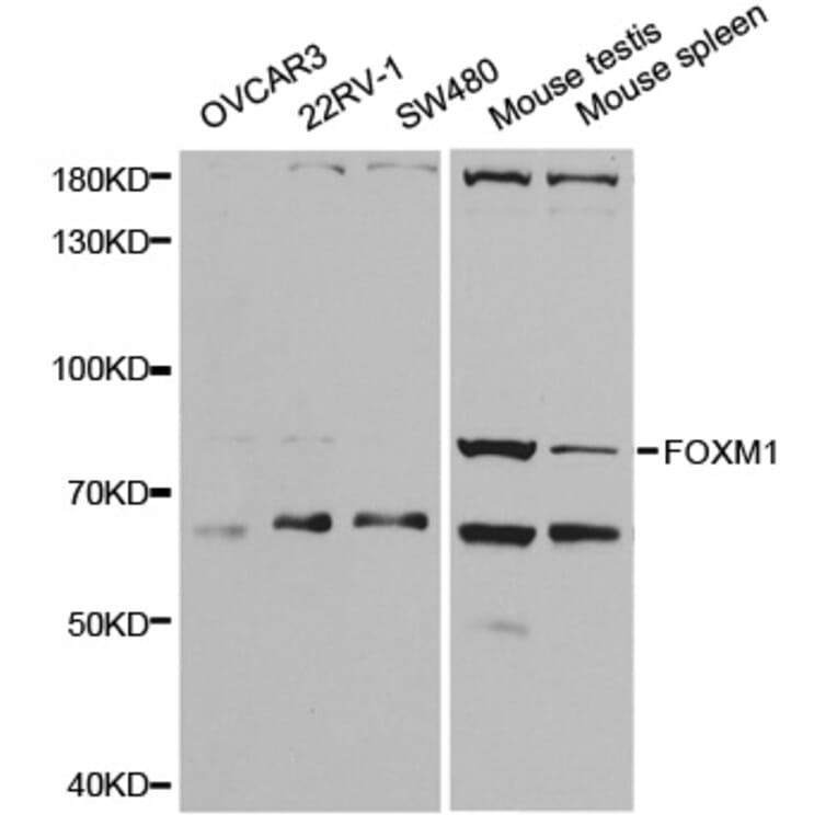 Western blot - FOXM1 Antibody from Signalway Antibody (32671) - Antibodies.com