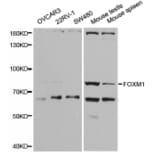 Western blot - FOXM1 Antibody from Signalway Antibody (32671) - Antibodies.com