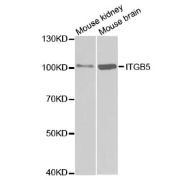 Western blot - ITGB5 Antibody from Signalway Antibody (32674) - Antibodies.com