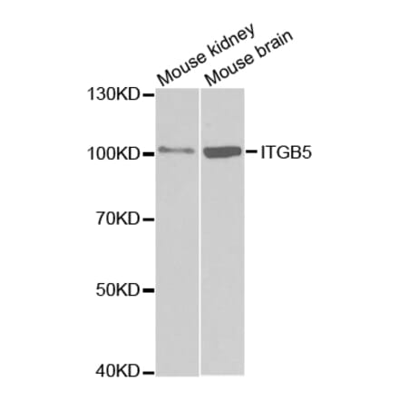 Western blot - ITGB5 Antibody from Signalway Antibody (32674) - Antibodies.com
