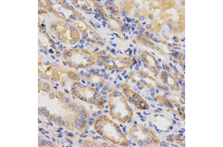 Immunohistochemistry - ITGB5 Antibody from Signalway Antibody (32674) - Antibodies.com