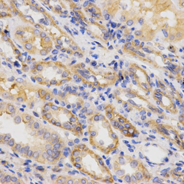Immunohistochemistry - ITGB5 Antibody from Signalway Antibody (32674) - Antibodies.com