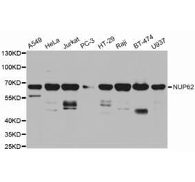 Western blot - NUP62 Antibody from Signalway Antibody (32676) - Antibodies.com