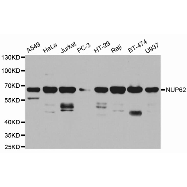 Western blot - NUP62 Antibody from Signalway Antibody (32676) - Antibodies.com