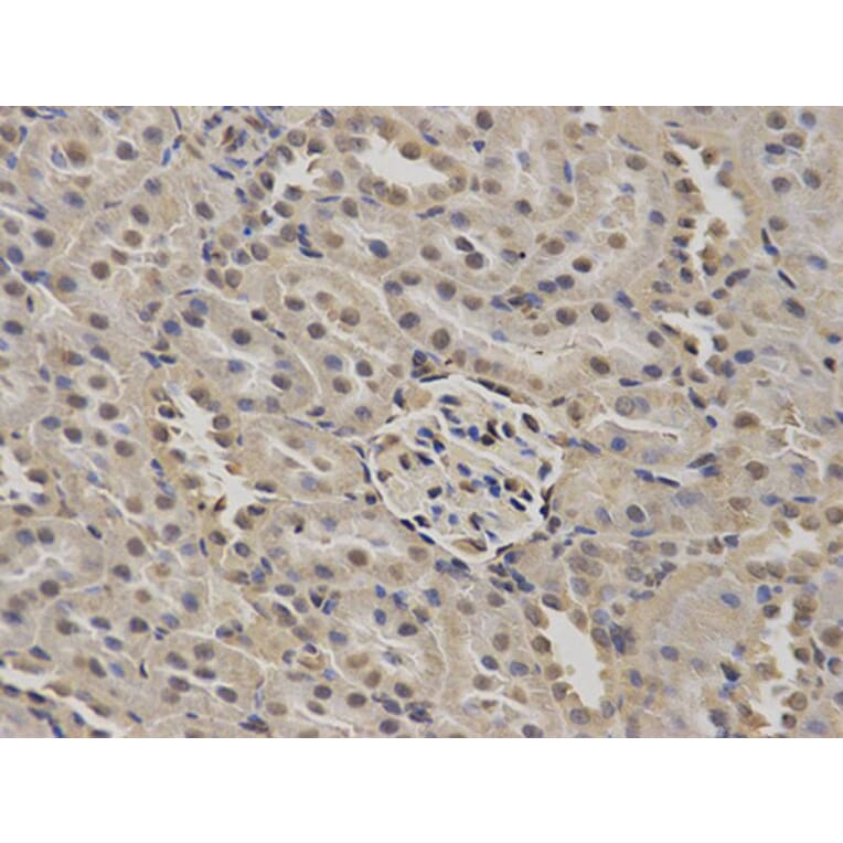 Immunohistochemistry - NUP62 Antibody from Signalway Antibody (32676) - Antibodies.com