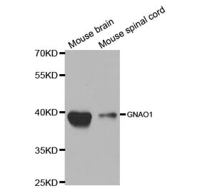 Western blot - GNAO1 Antibody from Signalway Antibody (32682) - Antibodies.com