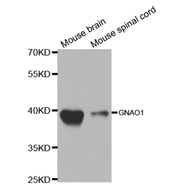 Western blot - GNAO1 Antibody from Signalway Antibody (32682) - Antibodies.com