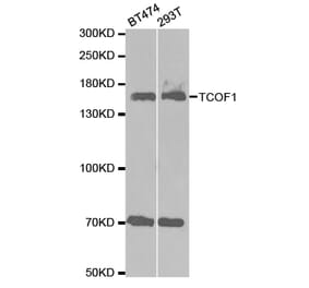 Western blot - TCOF1 Antibody from Signalway Antibody (32684) - Antibodies.com