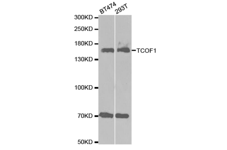 Western blot - TCOF1 Antibody from Signalway Antibody (32684) - Antibodies.com