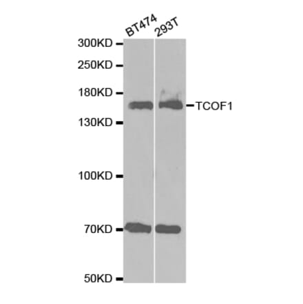 Western blot - TCOF1 Antibody from Signalway Antibody (32684) - Antibodies.com