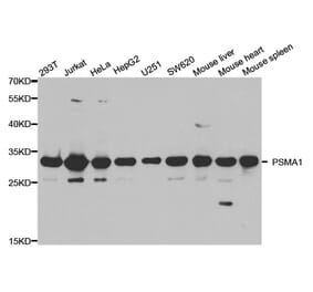 Western blot - PSMA1 Antibody from Signalway Antibody (32689) - Antibodies.com
