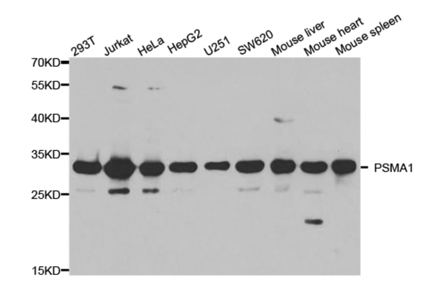 Western blot - PSMA1 Antibody from Signalway Antibody (32689) - Antibodies.com