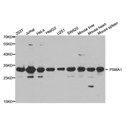Western blot - PSMA1 Antibody from Signalway Antibody (32689) - Antibodies.com