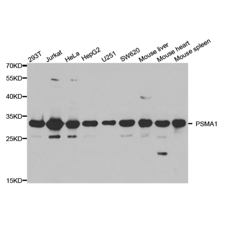 Western blot - PSMA1 Antibody from Signalway Antibody (32689) - Antibodies.com