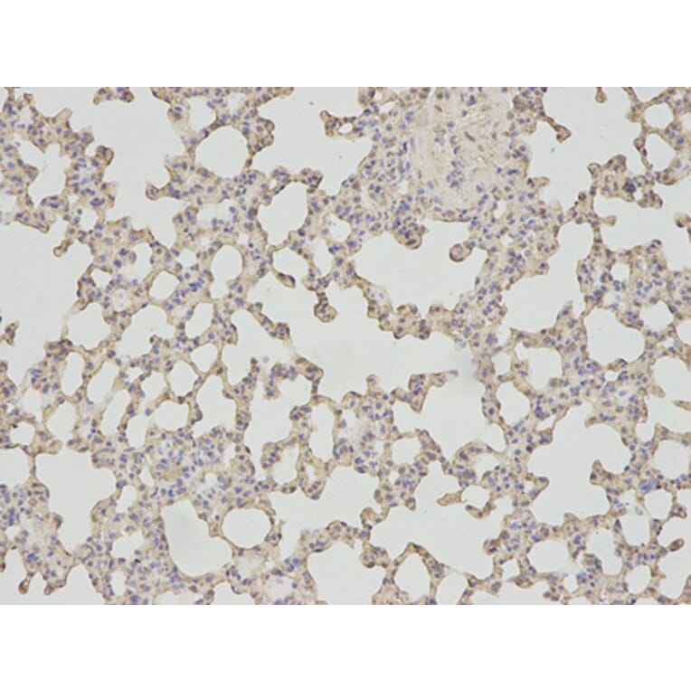 Immunohistochemistry - PSMA1 Antibody from Signalway Antibody (32689) - Antibodies.com