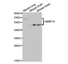 Western blot - MMP14 Antibody from Signalway Antibody (32707) - Antibodies.com