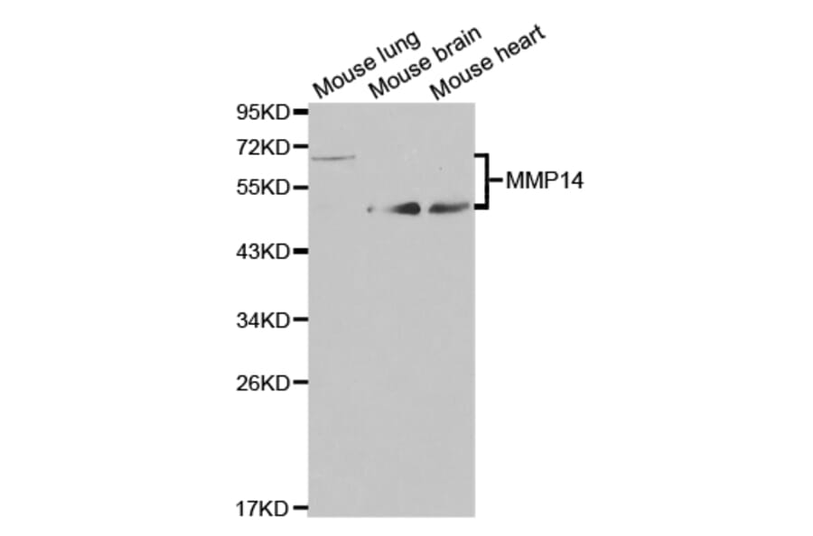 Western blot - MMP14 Antibody from Signalway Antibody (32707) - Antibodies.com