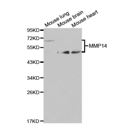 Western blot - MMP14 Antibody from Signalway Antibody (32707) - Antibodies.com