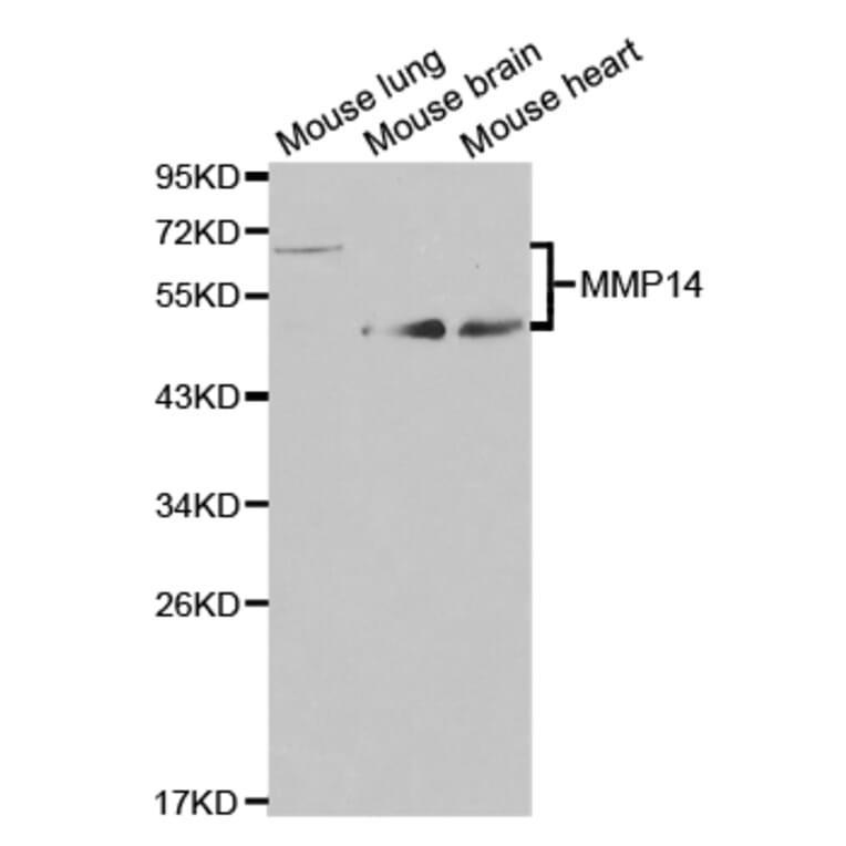 Western blot - MMP14 Antibody from Signalway Antibody (32707) - Antibodies.com