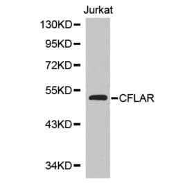 Western blot - CFLAR Antibody from Signalway Antibody (32710) - Antibodies.com