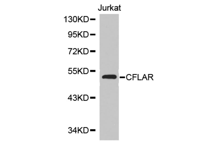 Western blot - CFLAR Antibody from Signalway Antibody (32710) - Antibodies.com