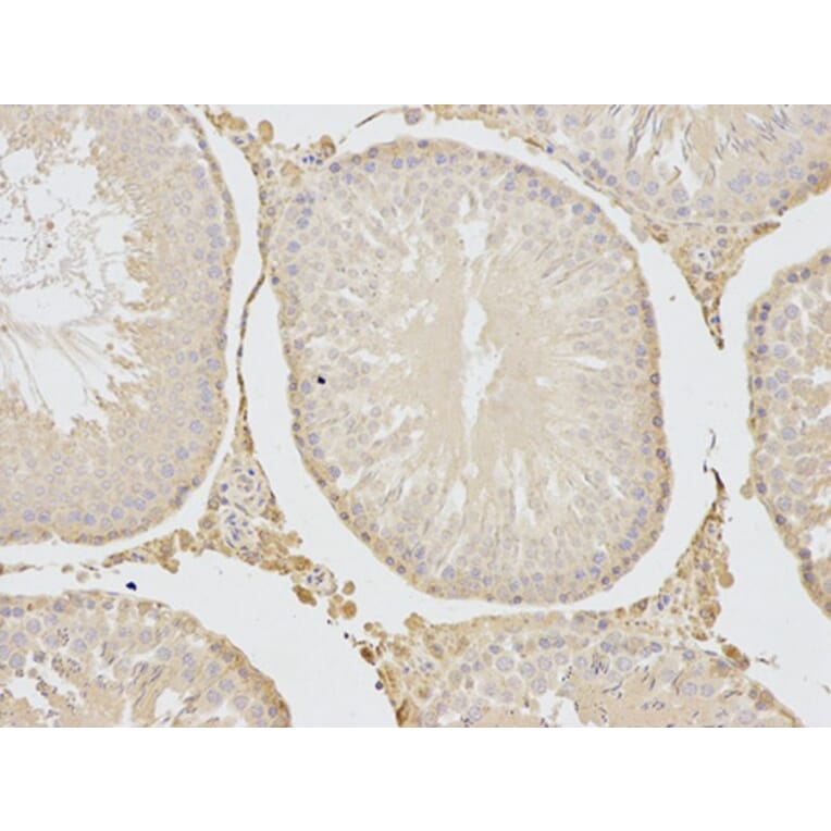 Immunohistochemistry - CFLAR Antibody from Signalway Antibody (32710) - Antibodies.com