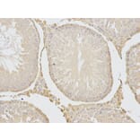 Immunohistochemistry - CFLAR Antibody from Signalway Antibody (32710) - Antibodies.com