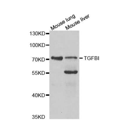 Western blot - TGFBI Antibody from Signalway Antibody (32714) - Antibodies.com