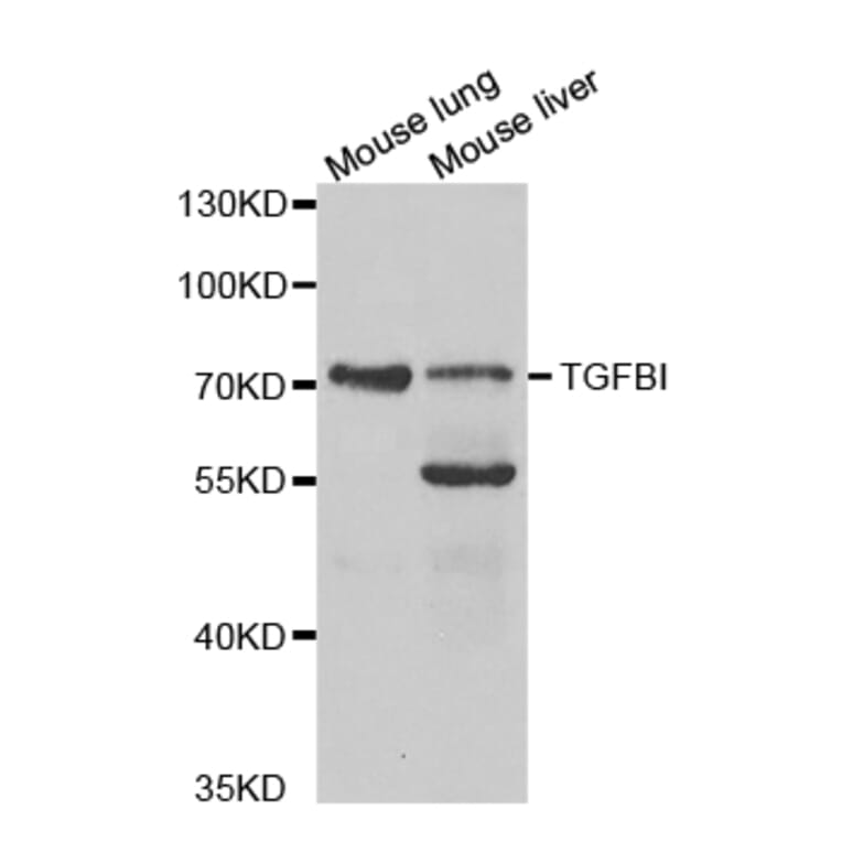 Western blot - TGFBI Antibody from Signalway Antibody (32714) - Antibodies.com