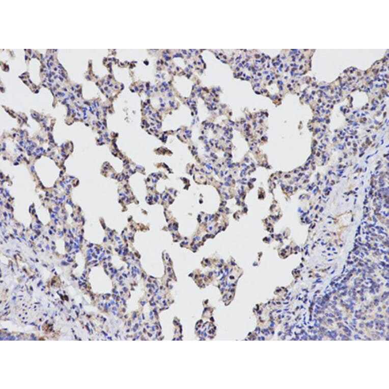 Immunohistochemistry - TGFBI Antibody from Signalway Antibody (32714) - Antibodies.com