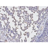 Immunohistochemistry - TGFBI Antibody from Signalway Antibody (32714) - Antibodies.com