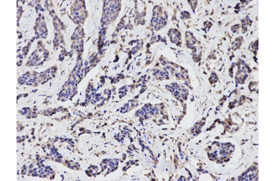 Immunohistochemistry - TGFBI Antibody from Signalway Antibody (32714) - Antibodies.com